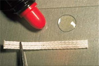 Ribbond Periodontal Splint