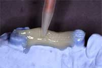 Ribbond Reinforced Provisional Bridge